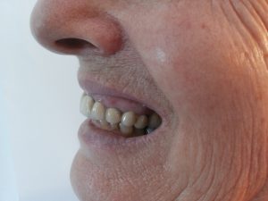 אישה עם שיניים
